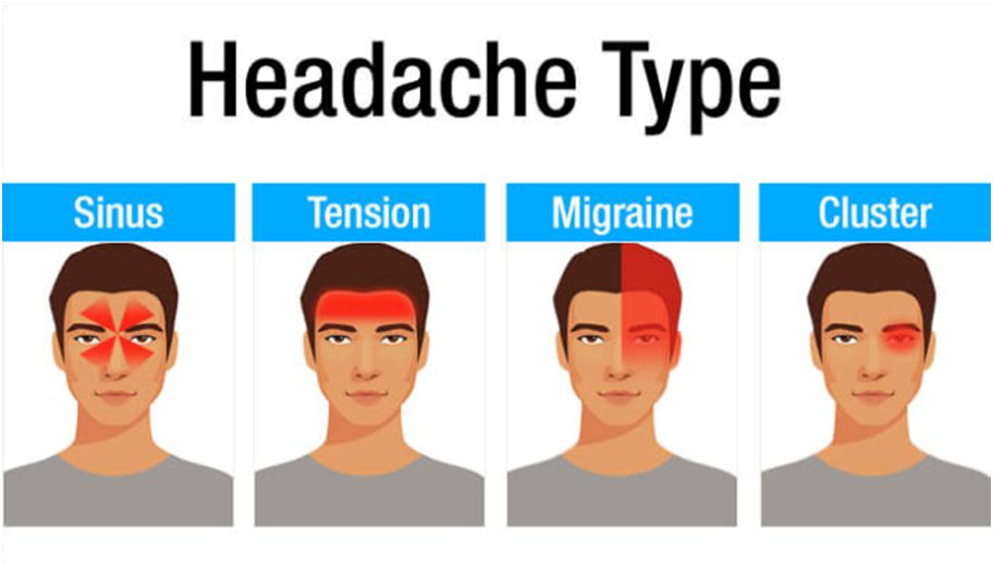 Headaches treatment by physiotherapy
