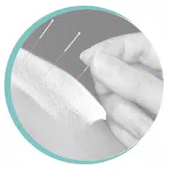 Acupuncture needles being applied to the body to support pain relief and recovery